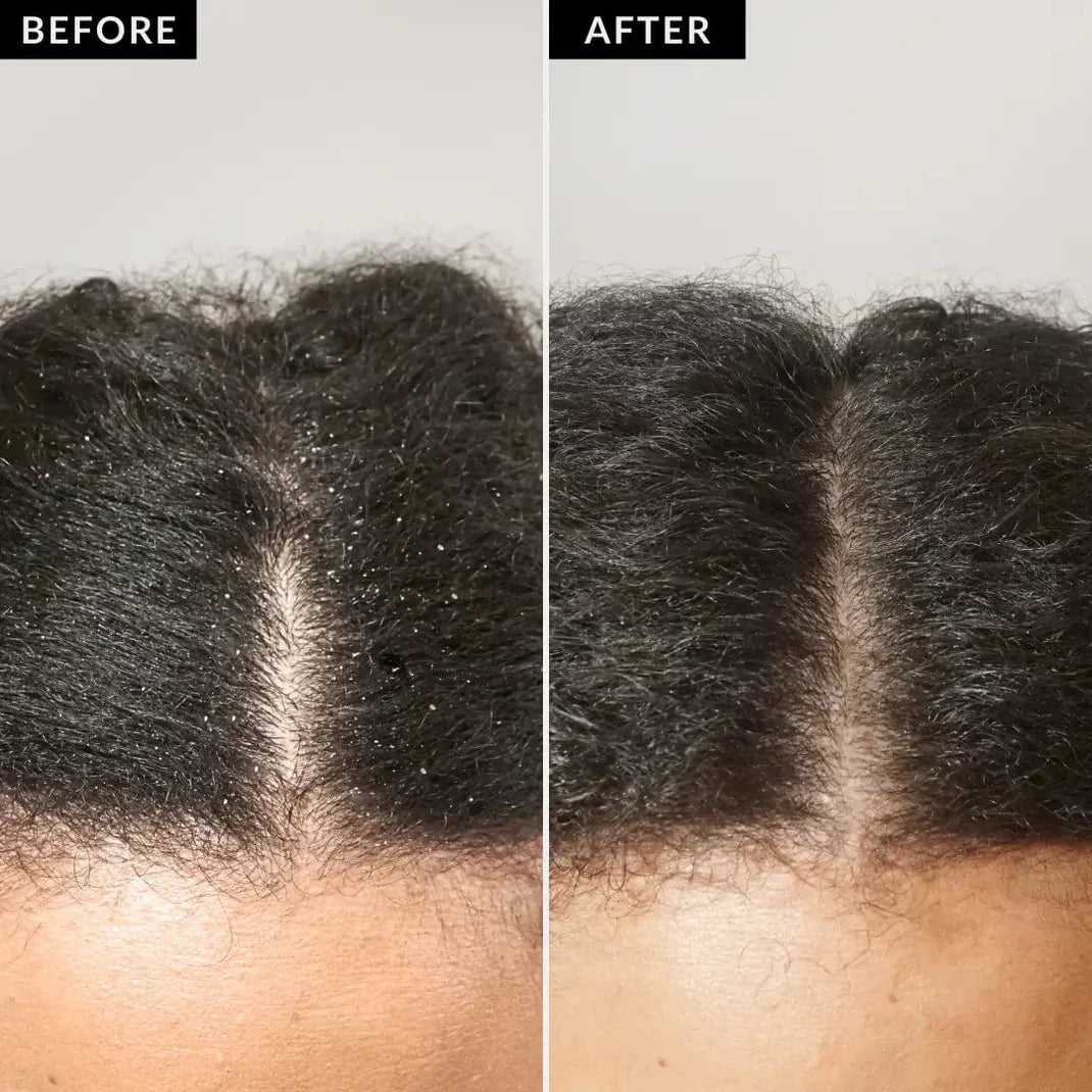 Clyvea Scalp Detox Comb